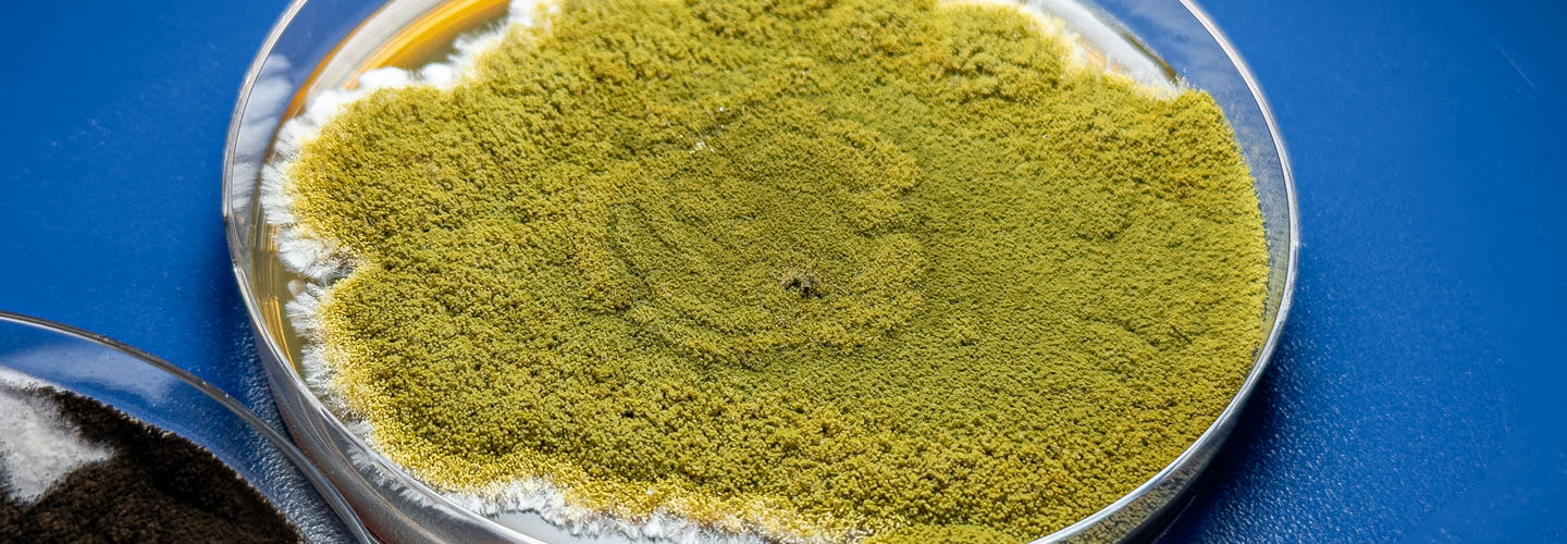 Bacteriología Micología