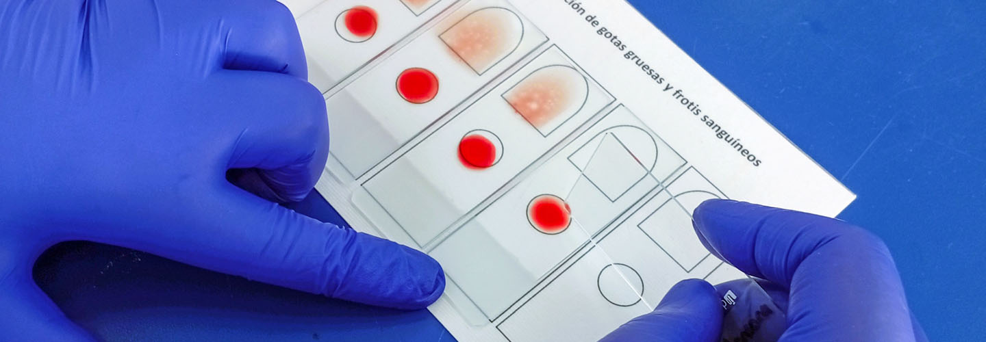 Centro Nacional de Referencia de Parasitología (CNRP)