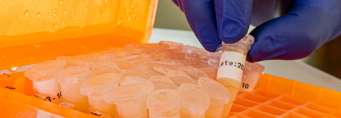 Centro Nacional de Referencia de Química Clínica (CNRQC)