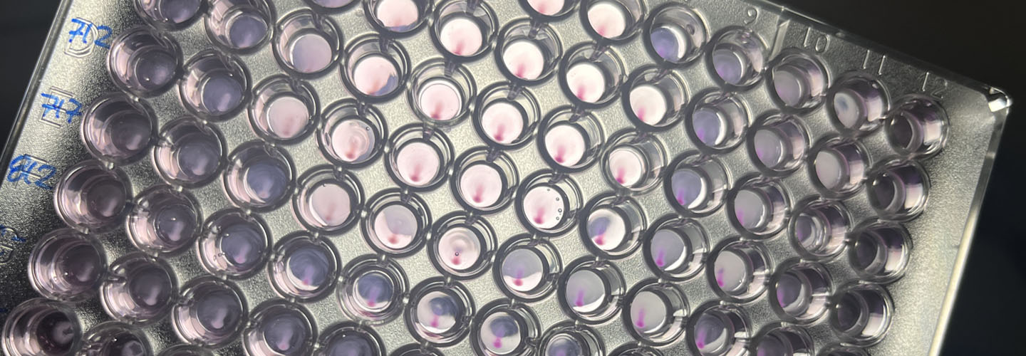 Laboratorio de Enfermedades Febriles Zoonóticas
