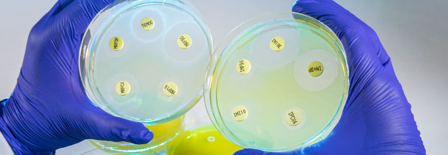 Laboratorio de Antimicrobianos